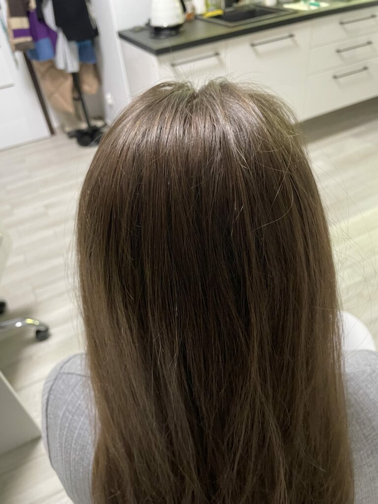 Zdrowa, zadbana skóra głowy to nie tylko kwestia kosmetyki. Milena Trycholog Bydgoszcz