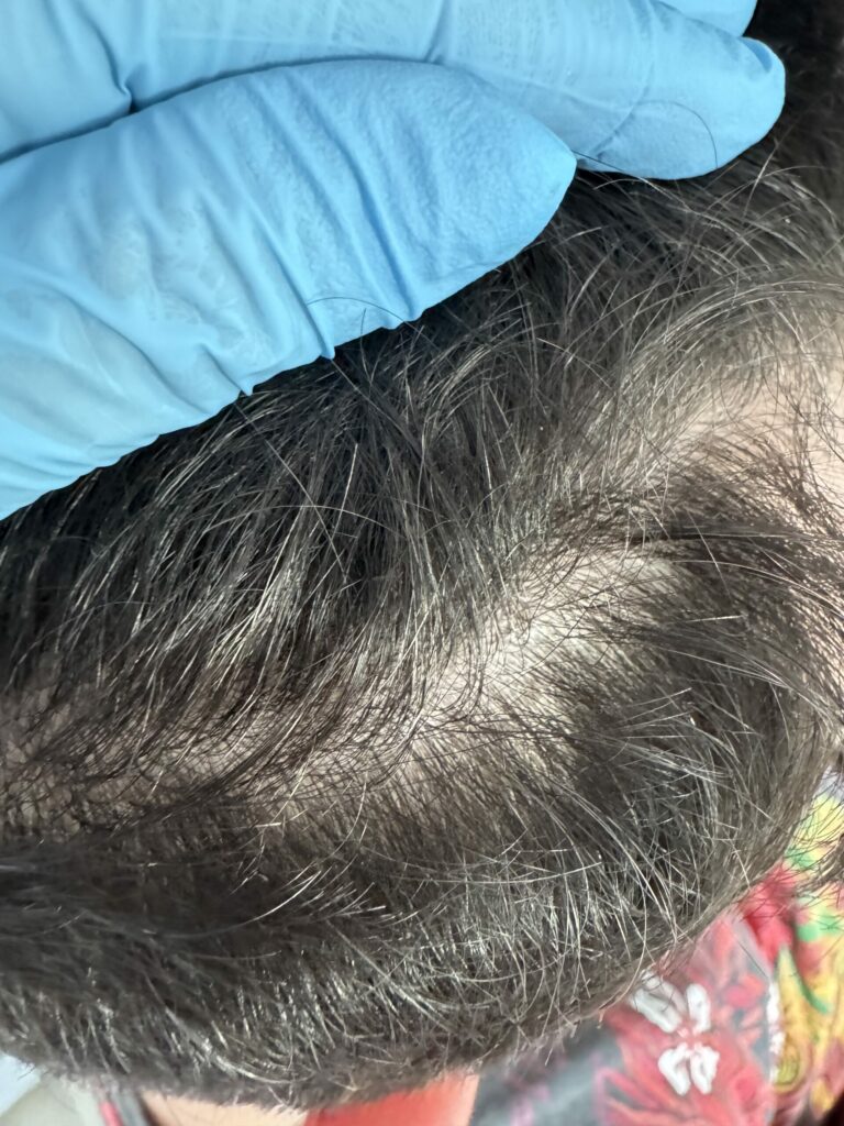 Trycholog Bydgoszcz Milena - Lotion Rozgrzewająco-Wzmacniający Bio-Hot L9 od Celltilab