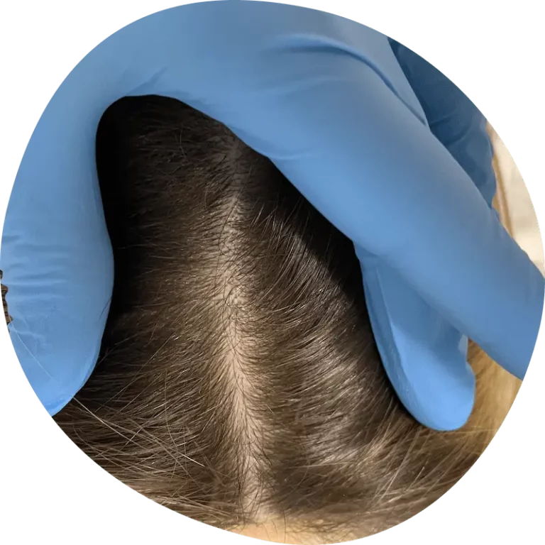 Trycholog Bydgoszcz – Milena Kwaśniewska, Specjalizuję się w diagnostyce i leczeniu problemów skóry głowy oraz włosów, oferując w gabinecie „Trycholog Bydgoszcz Milena” przy ul. Nowej 15 profesjonalne konsultacje oraz indywidualnie dobrane terapie, aby Twoje włosy były zdrowe i piękne. https://milena-trycholog.pl Najlepszy Trycholog w Bydgoszczy